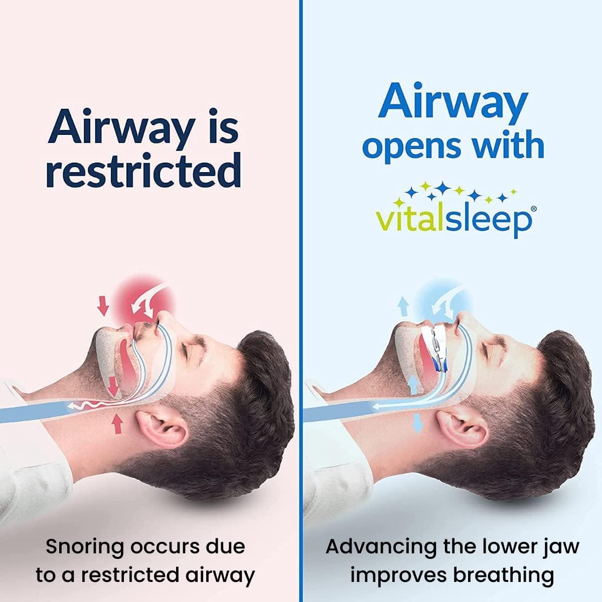 VitalSleep Anti-Snoring Mouthpiece + Sleep Mask, Custom Adjustable Jaw Positioning, USA Made & FDA Cleared Snoring Solution, BPA-Free, Comfortable Fit